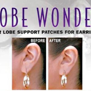 Before and after images showing earlobe support patches in use.