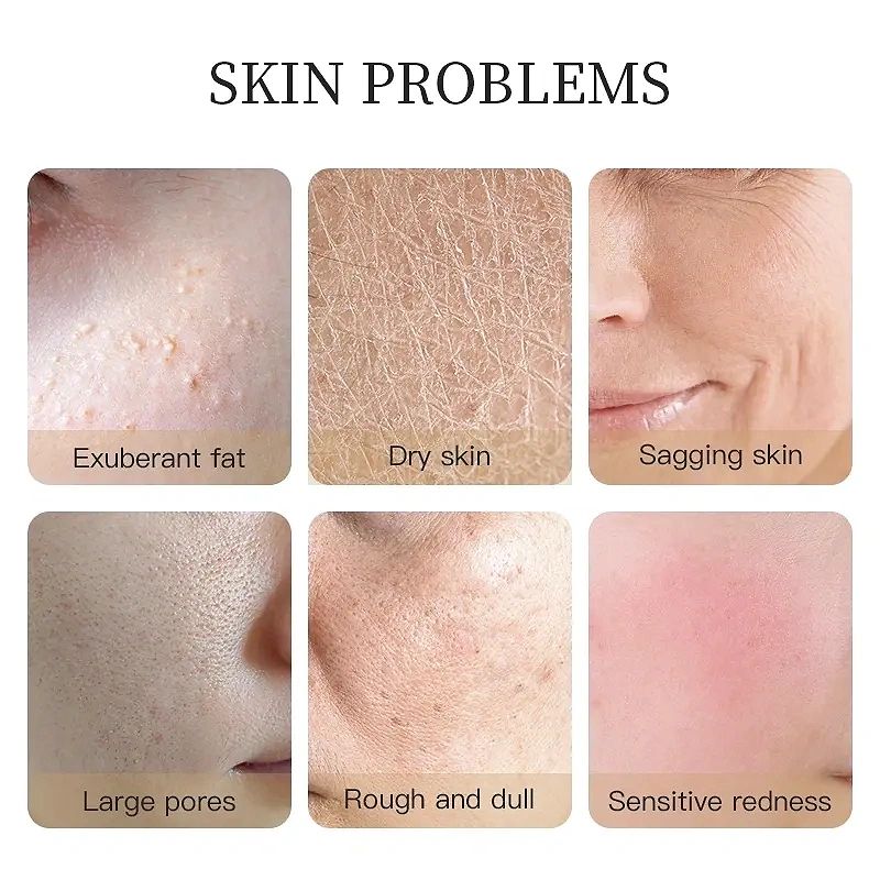Common skin problems including dry skin and sensitive areas.